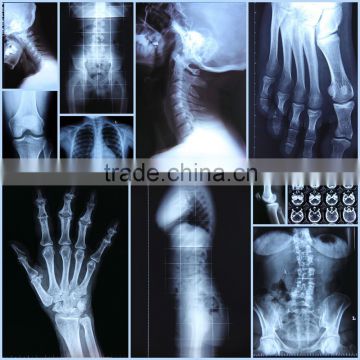 konida medical x ray dry imaging film, agfa fuji printing film