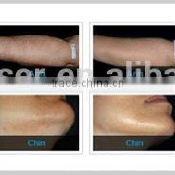 2014 Hot Seller !! Yuwei 808nm Hair Removal Beauty Machine With ce Approval photo-5