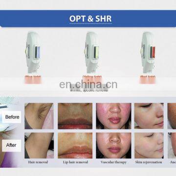 Hot Selling OPT IPL+RF+ND Yag Laser Price Multi Function Facial Device Beauty Machine Ipl Hair Removal Machine photo-5