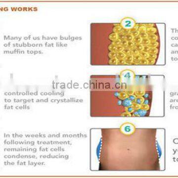 Vertical 2016 Portable Cryo Slimming Fat Freezing Liposuction Cryolipolysis Machine / Cryolipolysi Device Fat Reduce photo-5