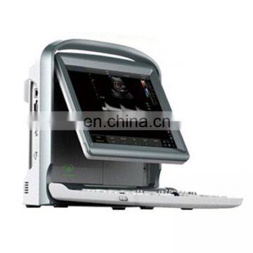 MY-A032 12 inch low power consumption Portable color doppler B ultrasound