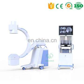 MY-D035 High frequency medical mobile C-Arm x-ray machine equipment