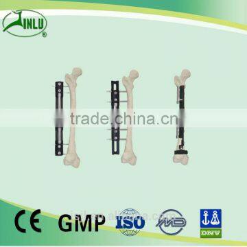 Bone Lengthening External Fixation Frame