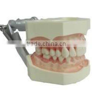 Gingival Dental Teeth Model for Prosthodontics Practice