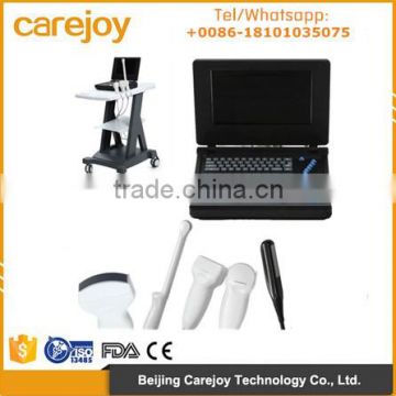 100% warranty CE ISO Approved 10.4 inch Laptop Ultrasound Machine/Scanner with 3.5Mhz Convex probe linear transvaginal rectal