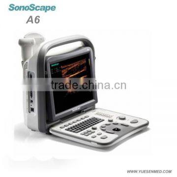 hot sell medical 2d portable color Sonoscape ultrasound a6