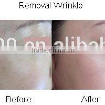 Newest Home Microdermabrassion Fractional Machine photo-3