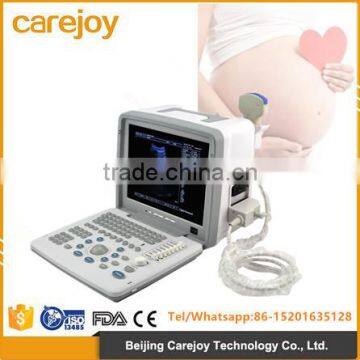 12-inch LCD monitor Digital LED portable ultrasound machine