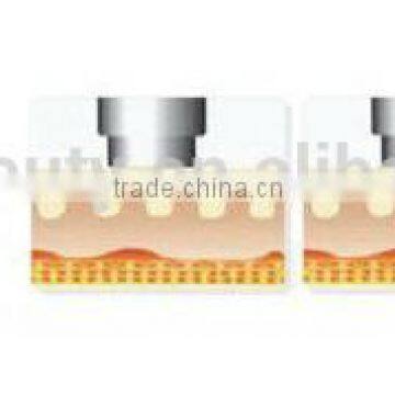 2015 Express Best Selling Products in America Wrinkle Remove PINXEL rf Fractional Micro Needle Machine