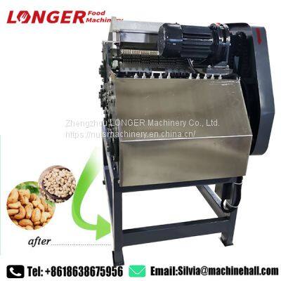 Hot Sale Cashew Nut Shelling Processing Machine Line China