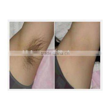 Supply Medical Affordable Permanent Hair Removal / at Home Laser Hair Removal Machines Keyword photo-6