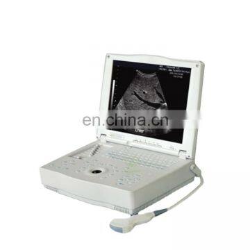 MY-A004 Hospital Sonar Ultrasound Equipment Portable Ultrasound Machine