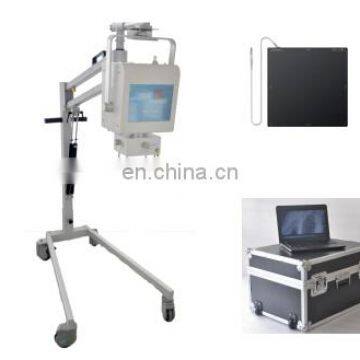 China High Quality MY-D019D Hospital Safeway Mobile X-ray System With Wheels photo-2
