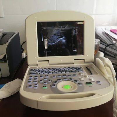 All Digital Ultrasonic Diagnosis SystemPortable Digital Acoustic Diagnostic Scanner for Human in Hospital photo-4