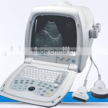 JOYFUL Price of Digital Ultrasound Machine photo-2