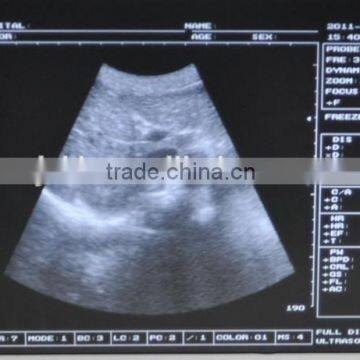 CE Approved Laptop/Portable Ultrasound Scanner With 3.5Mhz Multi-frequency Convex Probe photo-2