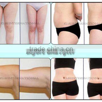 Fat Melting Multifunction Cavitation Vacuum Slimming 2000 Shots Double Chin Removal Machine/home Use Hifu Slimming Machine Hips Shaping photo-6