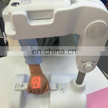 Cheapest Advanced Portable Clinic Handheld Infrared Vein Detector/ Vein Finder for Whole Body Skin Use photo-5