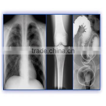 x-ray digitizer fuji, thermal x ray film of suppliers of hospital products