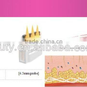 3 Transducer HIFU Face Rejuvenation Wrinkle Removal System FOR SPA /CLINIC photo-5