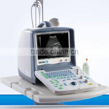 Body checking ultrasound system portable ultrasound scan machine