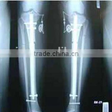 fuji medical x-ray film, medical x-ray film agfa of medical equipment wholesale