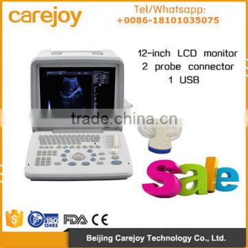 Carejoy portable Ultrasound Machine Ultrasounic Scanner with 3.5Mhz convex probe RUS-9000B with CE ISO mark