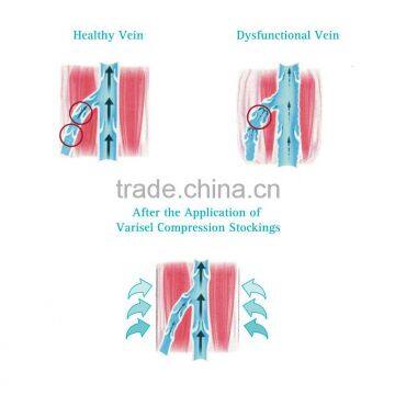 Turquoise Compression Stockings VTK2-300