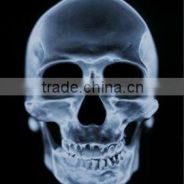 Medical X-ray Film /fuji Printing Clear Image Medical Dry Film With Factory Price photo-4