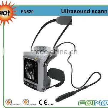 FN520 HOT selling portable ultrasound machines for sale