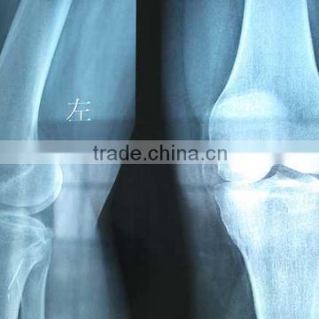 China medical disposables and consumables medical films KND-A/F CE