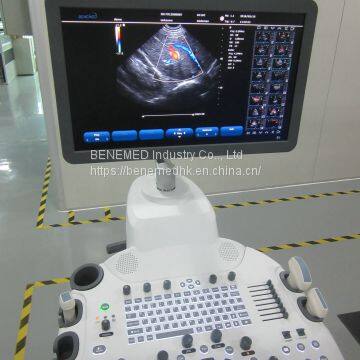 Trolly 2D Echocardiography Color Doppler Ultrasound Scanner photo-2