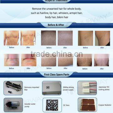 Most Effective Professional Unhairing Laser Epilation 808nm Lumenis Diode Laser Hair Removal Machine photo-5