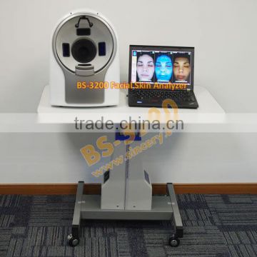 Skin lesion analysis beauty machine for beauty salon using