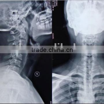 medical x-ray film agfa, agfa film dt2b of suppliers of hospital products