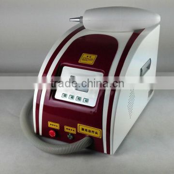 Qswitch nd yag laser tattoo removal system