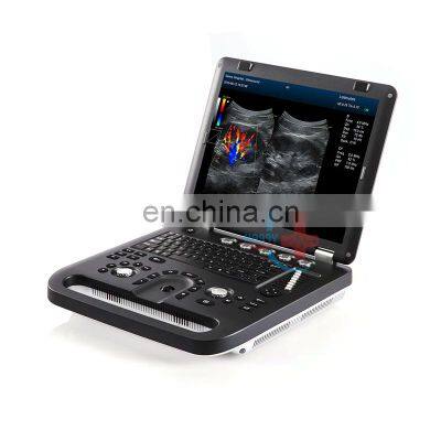 HC-A013A Cheap Price Medical Laptop Color Doppler Ultrasonic Diagnostic System Portable Color Doppler Ultrasound