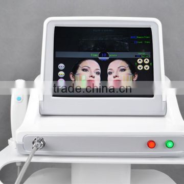 HIFU 2016 RF Skin Rejuvenation Facial Care Wrinkle Removal Machine face lift