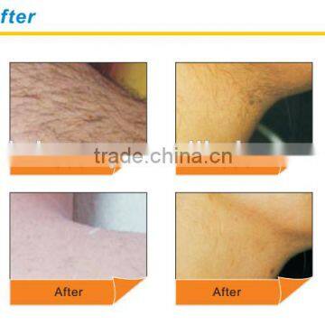 2000W 808nm Diode Laser Hair Removal Machine For Permanent Hair Removal 10-1400ms photo-6