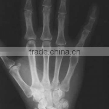 China medical x-ray image KND-A/F CE