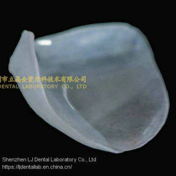 Ultra-thin Dental Veneers, Porcelain Veneer, Dental Laminates, Laboratoire Dentaire, Dentallabor, Laboratorio Dental, Dental Laboratory, Shenzhen LJ Dental Lab China