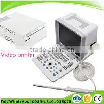 portable Ultrasound Machine with 3.5Mhz convex probe or linear transvaginal video printer optional