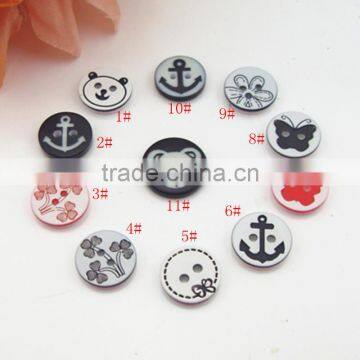 Monopoly multi-style multi- button sub- varieties of sub- wholesale children's clothing buttons