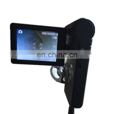 HC-G055 Portable Digital Microscope Dermatoscope Dermatology Department Beauty Salon