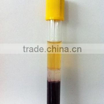 vacuum blood collection gel clot activator tube