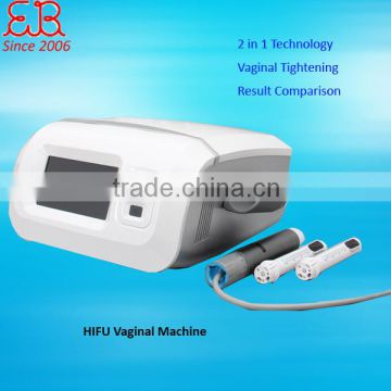 Skin Rejuvenation Salon HIFU Vaginal Tightening Portable Machine Professional HIFU Vaginal Machine 0.1-2J