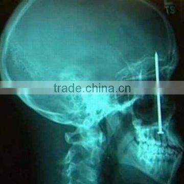 ct scan films of alibaba+cina, medical x-ray film agfa of alibaba supplier