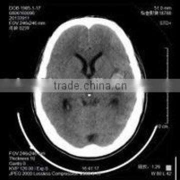 Imaging medical ray film,digital x-ray cr,agfa dry film sale from Chinese manufacturer