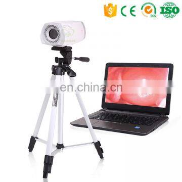MY-F003 Medical Gynaecology Electronic Portable Digital Colposcope Price photo-2