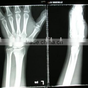 x-ray blue film, fuji dry film,medical dry film for medical equipment in china